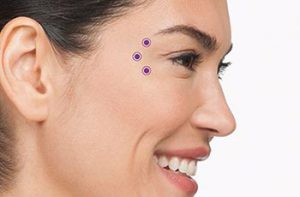 get rid of wrinkles on your face