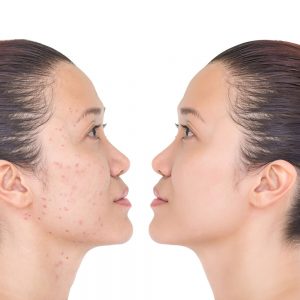 Is retinol bad for skin