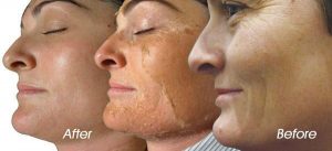 treat dull skin